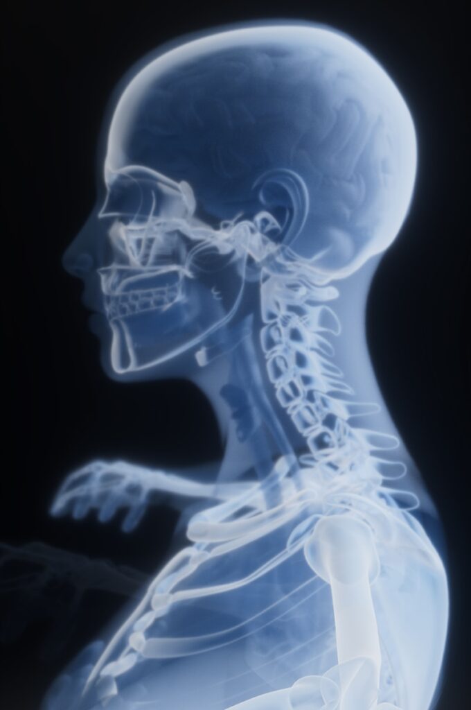 X-ray of a human skeleton and head